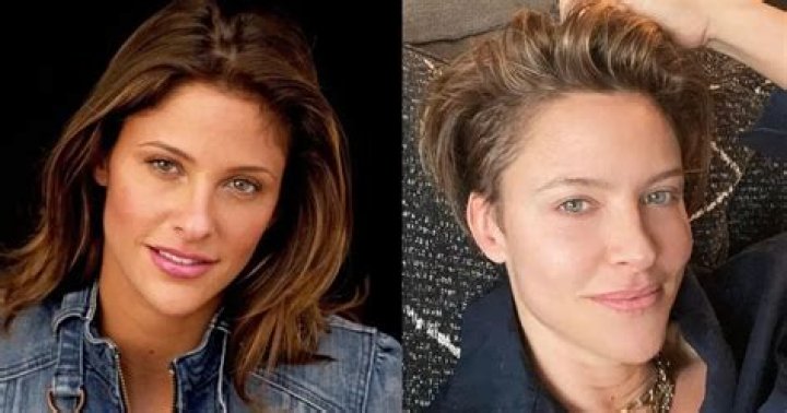 Jill Wagner Plastic Surgery: From Rhinoplasty to Fillers and What Not!