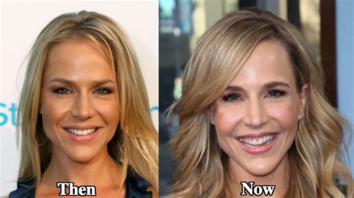 Julie Benz Breast Implants Plastic Surgery Before and After