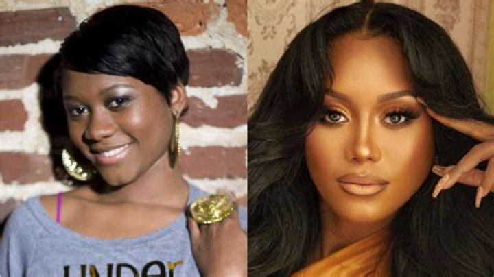 Muni Long Plastic Surgery: Apparent Changes in Muni Long's Look and Anticipated Procedures!