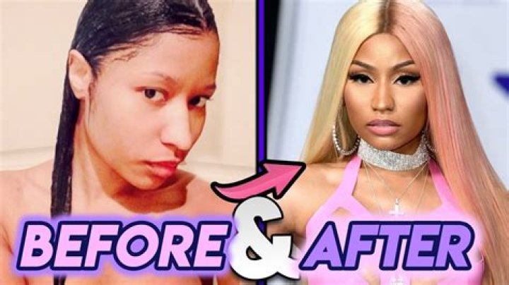 Nicki Minaj Before and After: The Art of Reinvention!