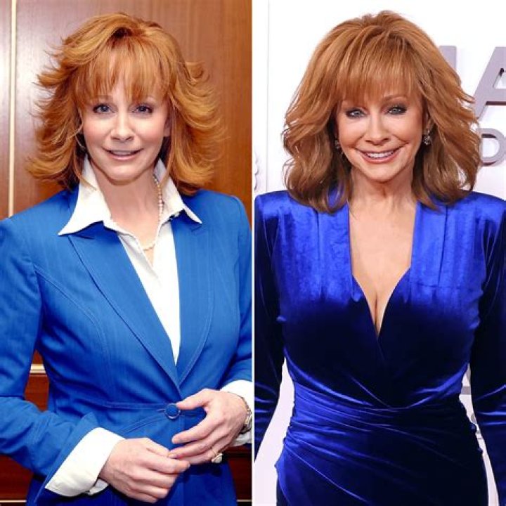 Reba McEntire Plastic Surgery: From Rumors to Reality