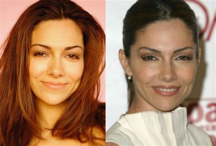 Vanessa Marcil Plastic Surgery Before and After